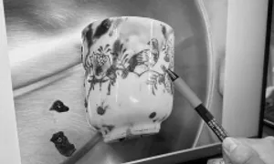 Người đàn ông hoại tử ruột vì chiếc cốc sứ trong hậu môn